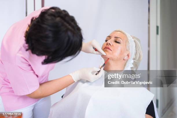 plastic surgeon marking face of a patient - mesotherapy stock pictures, royalty-free photos & images
