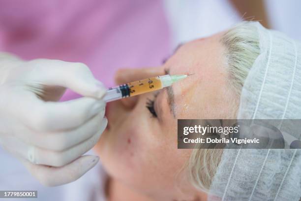 woman having prp treatment for the forehead area - mesotherapy stock pictures, royalty-free photos & images