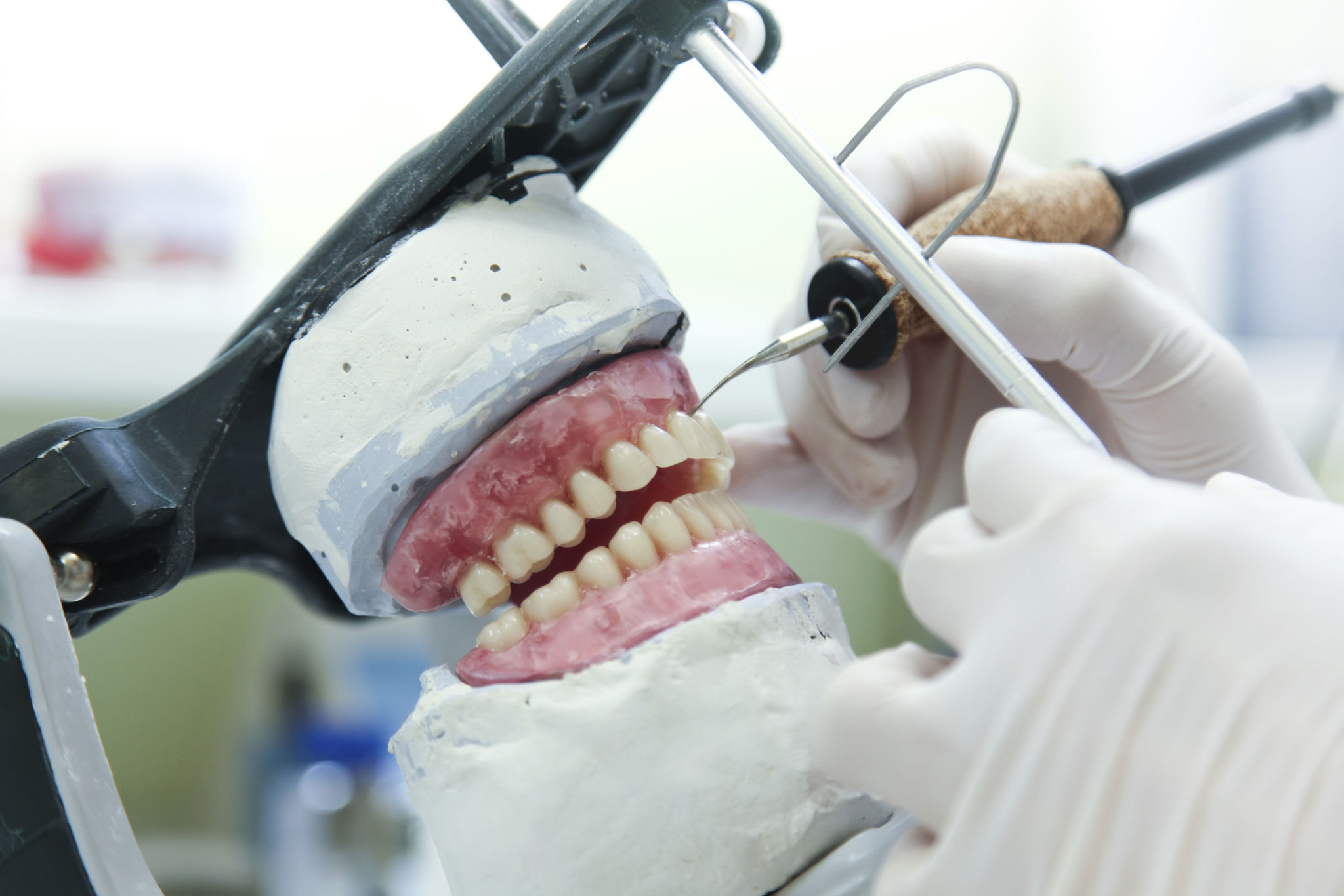custom dental prosthesis