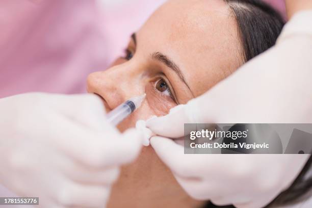 woman having hyaluronan injected on a cosmetic appointment - ácido hialurónico imagens e fotografias de stock