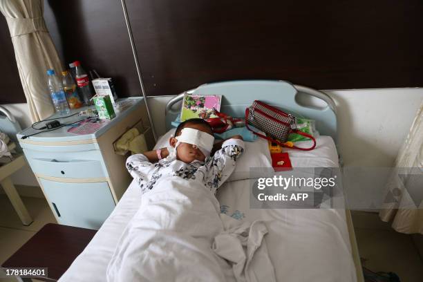 Boy lies on his hospital bed with his eyes covered with bandages in a hospital in Taiyuan, north China's Shanxi province on August 27. The...