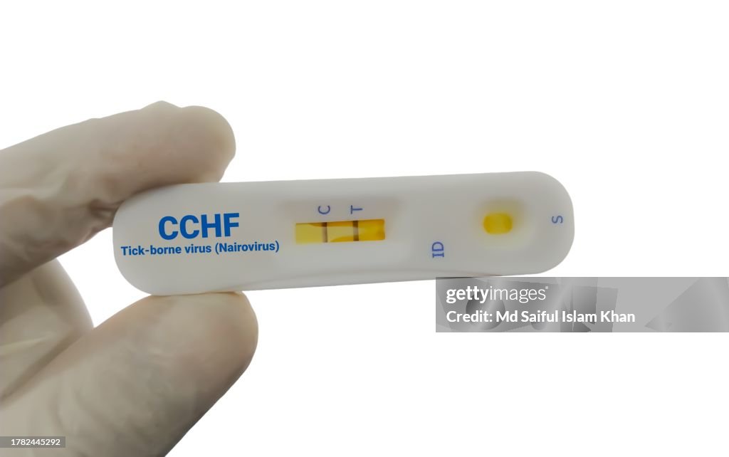 CCHF (Crimean Congo hemorrhagic fever) rapod test. Tick borne virus (Nairovirus) Test