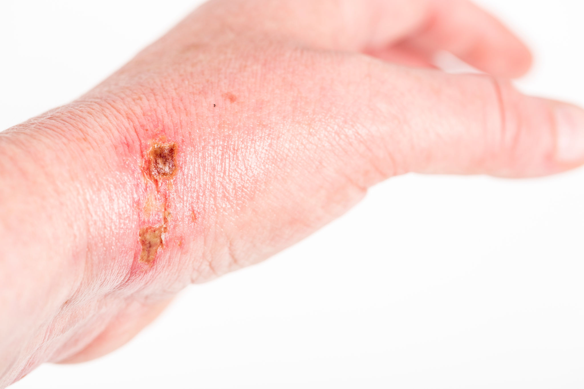 professional striping