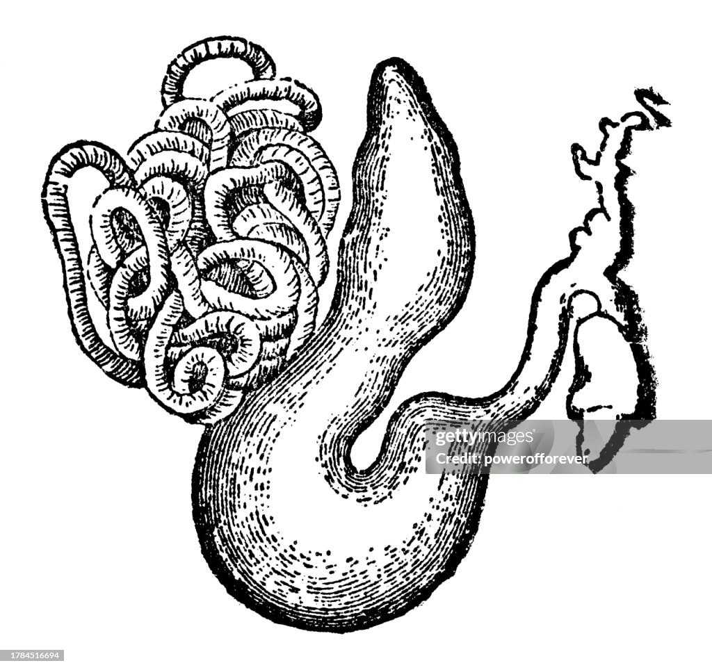 Cod Worm (Lernaeocera Branchialis) - 19th Century