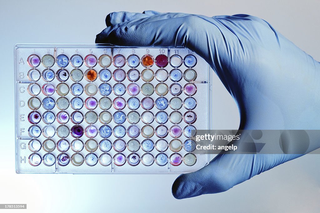 Hand with a microplate assay