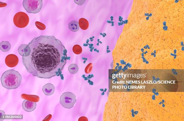 rheumatoid arthritis, illustration - autoimmune disease 幅插畫檔、美工圖案、卡通及圖標