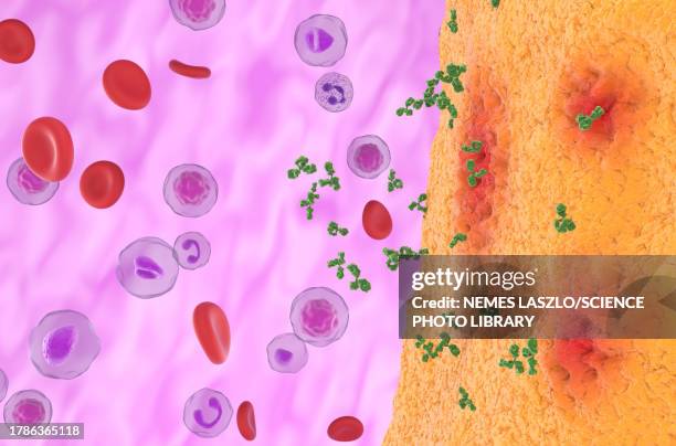 rheumatoid arthritis treatment, illustration - gelenkrheumatismus stock-grafiken, -clipart, -cartoons und -symbole