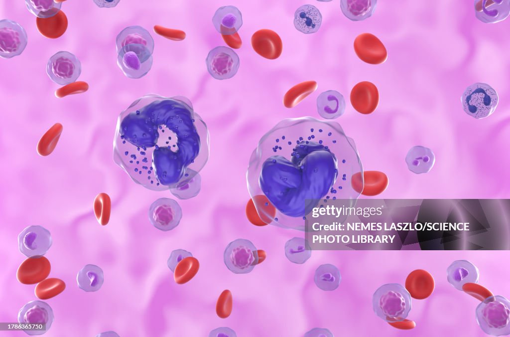 Chronic myeloid leukaemia, illustration