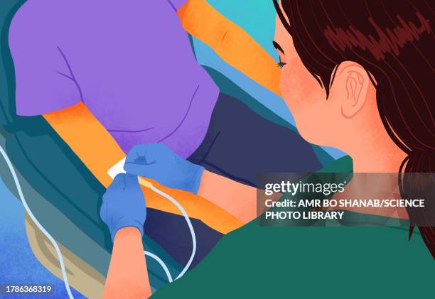 nurse attaching iv line, illustration - catheter illustration stock illustrations