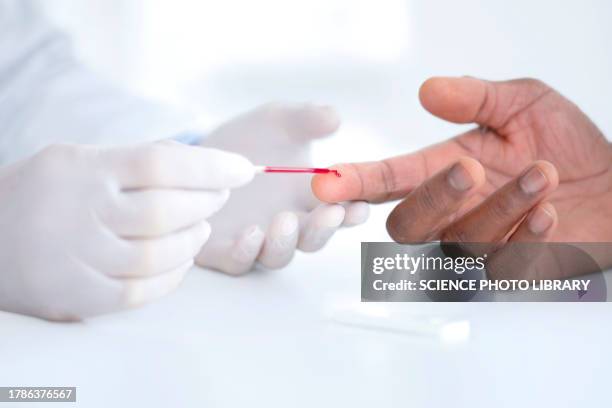 Capillary Finger 1,466 Capillaries Stock Photos, High-Res Pictures, and Images - Getty ...