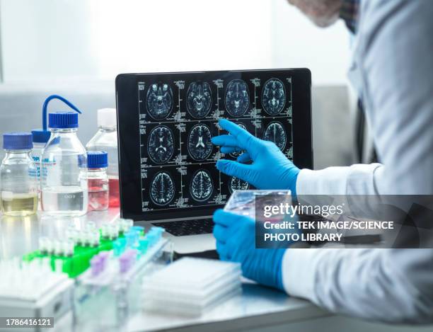 neurology research, conceptual image - demens bildbanksfoton och bilder