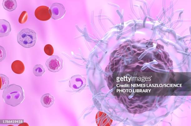 hairy cell leukaemia, illustration - cancer illness stock illustrations