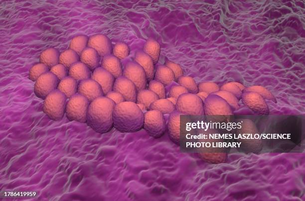 endometrial cancer, illustration - endometrial cancer stock illustrations