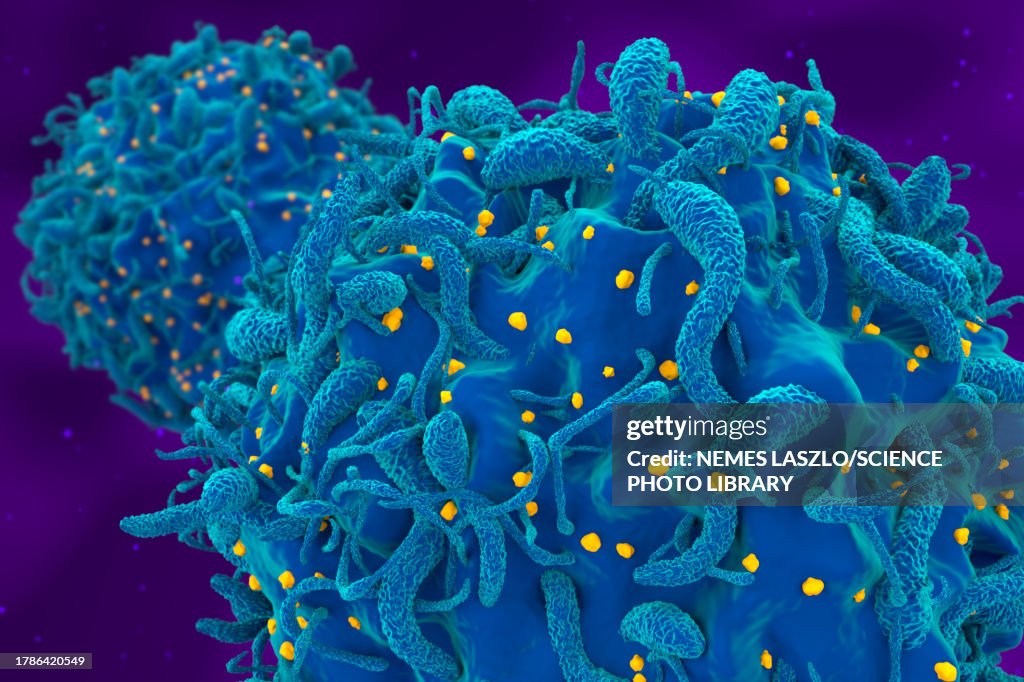 Infested Cells Cells Infected With Hiv Illustration High-Res Vector Graphic - Getty Images