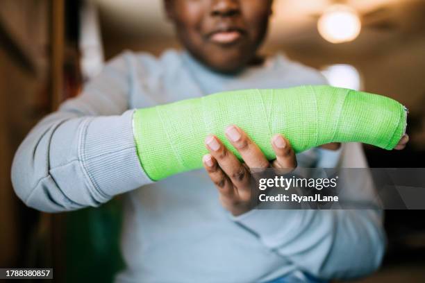 junge zeigt seinen gips auf gebrochenen arm - knochenbruch stock-fotos und bilder