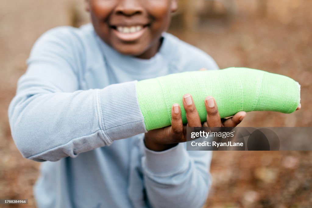 Boy Shows of His Cast on Broken Arm