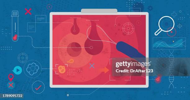 colonoscopy concept - oncology abstract stock illustrations