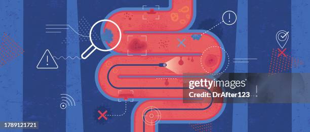colonoscopy diseases detected - colonoscopy stock illustrations
