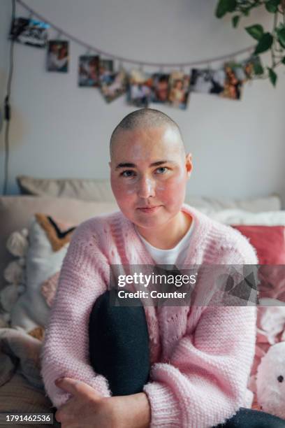 portrait of woman recovering from illness at home - complètement chauve photos et images de collection