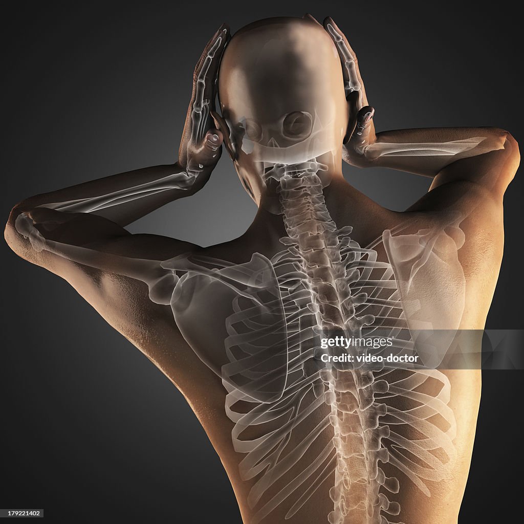 Human Radiography Scan High-Res Stock Photo - Getty Images