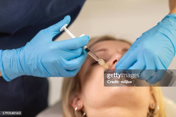 young woman having hyaluronic lip treatment - lip injections stock pictures, royalty-free photos & images