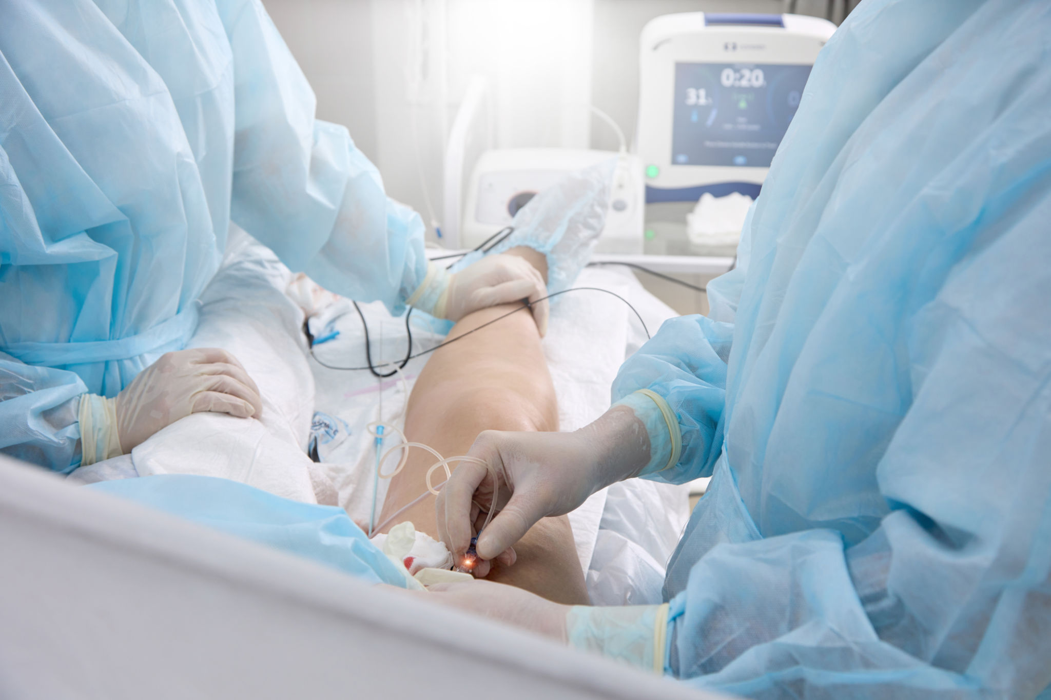 radiofrequency ablation