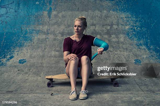 girl with broken arm - broken arm stock pictures, royalty-free photos & images