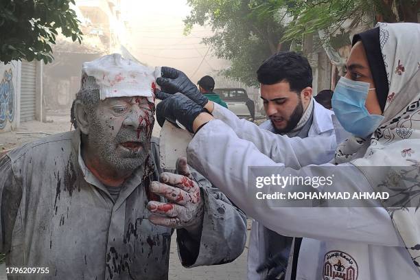 Palestinian man receives treatment after an Israeli strike near the Kamal Adwan hospital in Beit Lahia in the northern Gaza Strip on November 22,...