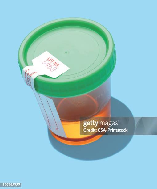 urine sample - urine cup stock illustrations