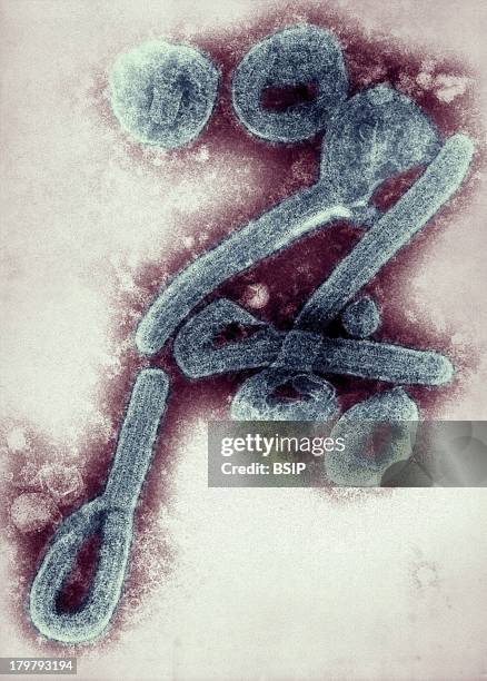 Marburg Virus, Electron Micrograph Of The Marburg Virus, First Recognized In 1967, Causes A Severe Type Of Hemorrhagic Fever, Which Affects Humans,...