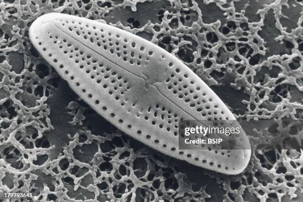 Diatom, Sem, Pinnularia Diatom, Valve Displays Little Holes, Termed Stria, Striae, Arranged In Rows, Sem 4800X.