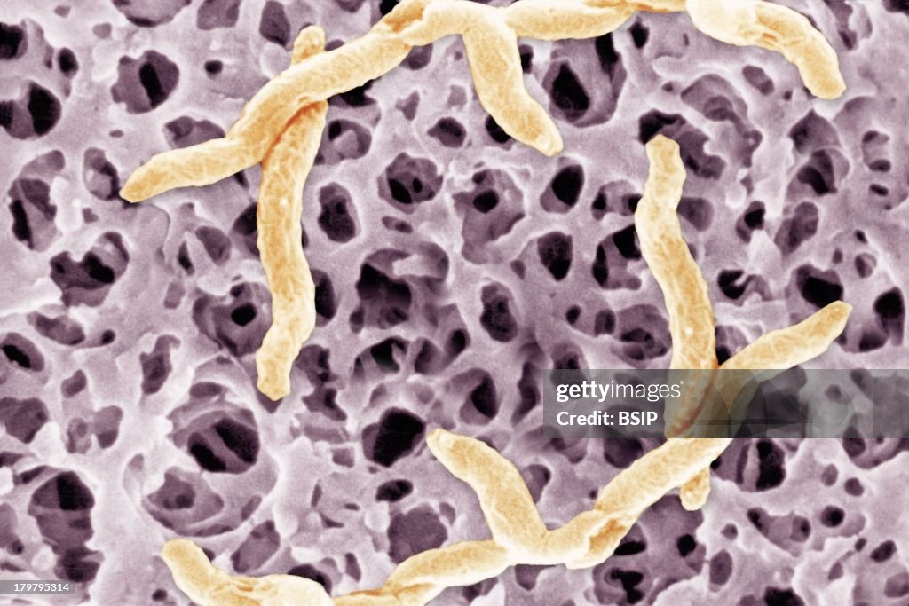 Campylobacter Jejuni