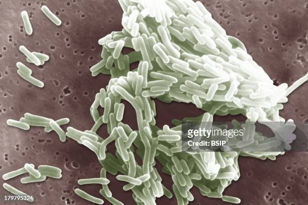 Listeria Monocytogenes, Scan Electron Micrography, Listeria Monocytogene.