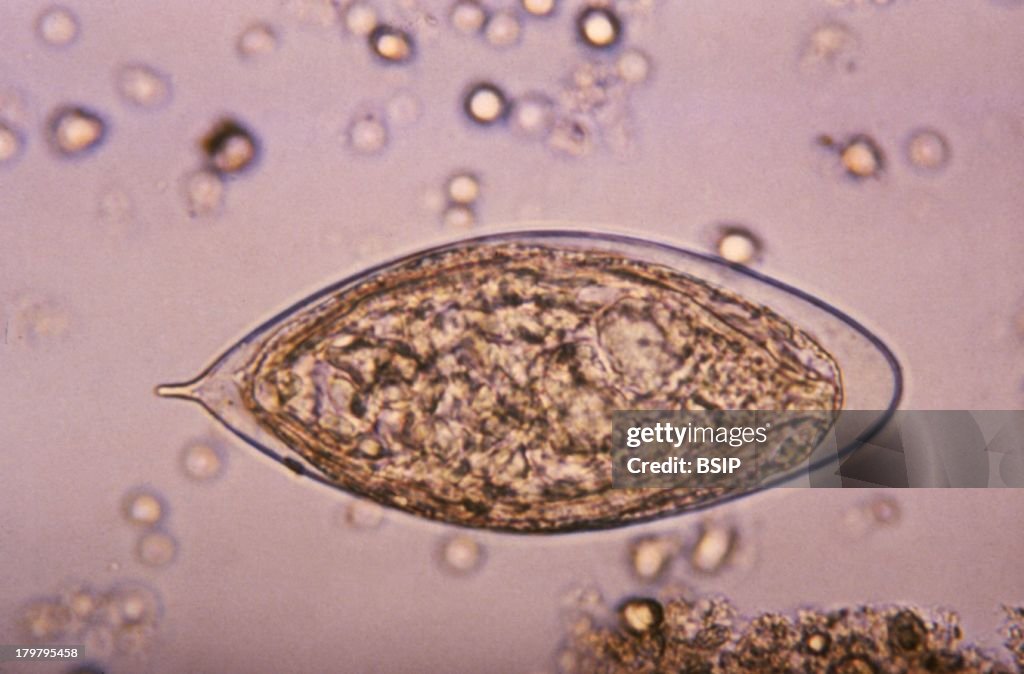 Schistosoma Haematobium
