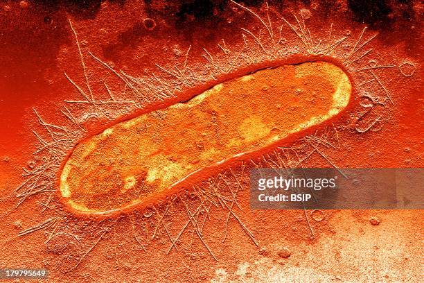 Escherichia Coli, Tem, Bacterial Pili, Filamentous Extensions Protruding From The Cell, Which Play An Important Role In Bacterial Adhesion To Mucosal...
