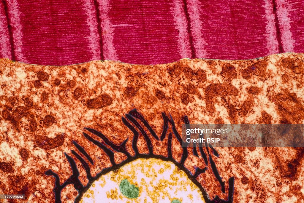 Skeletal Muscle, Tem