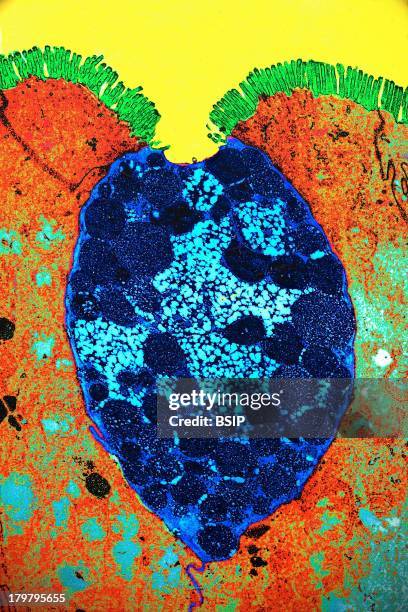 Goblet Cell, Tem, Enterocyte Renewal Is Rapid, Lifespan 3 to 4 Days, Sem, Stained, X 8000.