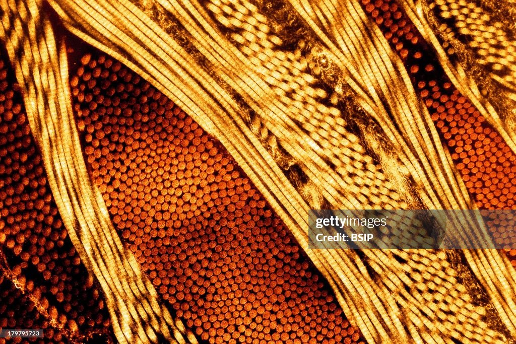 Collagen