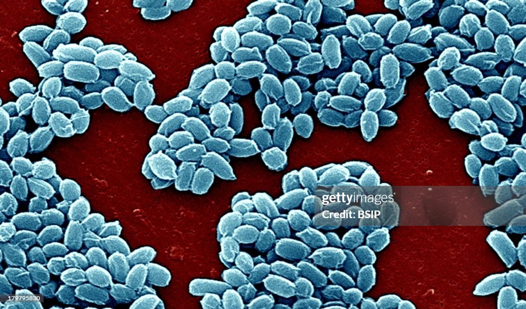 Anthrax Bacterium Spore, Sem