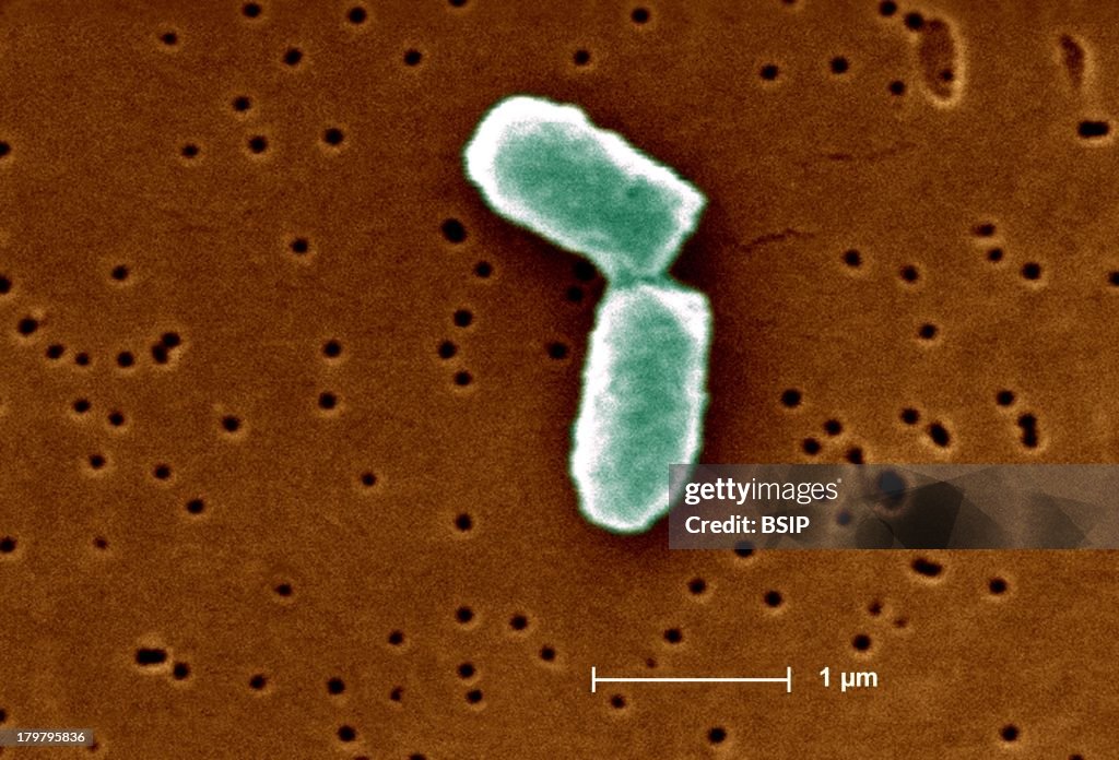 Escherichia Coli, Sem