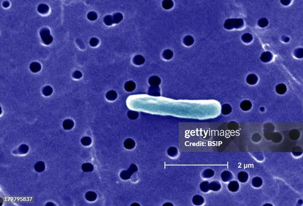 Escherichia Coli, Sem, Infection Can Also Occur After Drinking Raw Milk And After Swimming In Or Drinking Sewage-Contaminated Water.