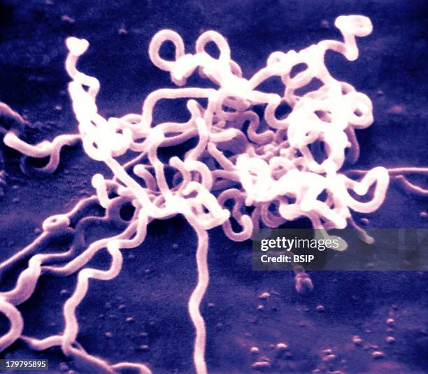 Treponema Pallidum, Sem, Treponema Pallidum On Cultures Of Cotton Tail Rabbit Epithelium Cells, Sf1Ep, Treponema Pallidum Is The Causative Agent Of...