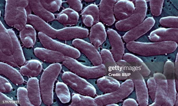 Vibrio Vulnificus, Septic Shock And Blistering Skin Lesions, V, Vulnificus Bloodstream Infections Are Fatal About 50 percent Of The Time.