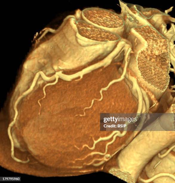 Normal Ct Transectionhal View 95 And Normal Ct Scan Stock Photos, High-Res Pictures, and Images ...