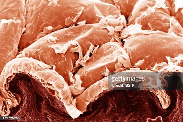 Skin, Sem, Horizontal Section Of Human Skin, Showing Squamous Epithelium On The Surface, A Section Of Epidermis, And The Dermis, Sem 210X.