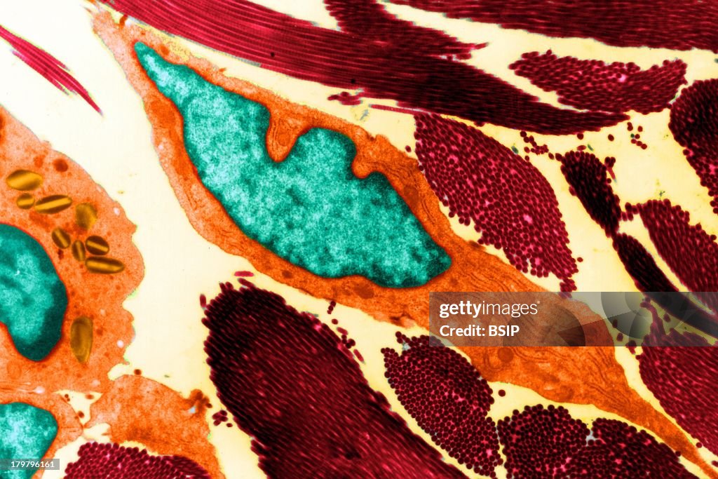 Fibroblast