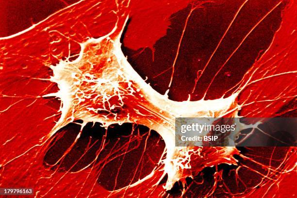 Mitosis Anaphase, Cell Division Enabling Duplication Of The Chromosomes And The Formation Of Two Identical Daughter Cells, There Are Four Phases Of...