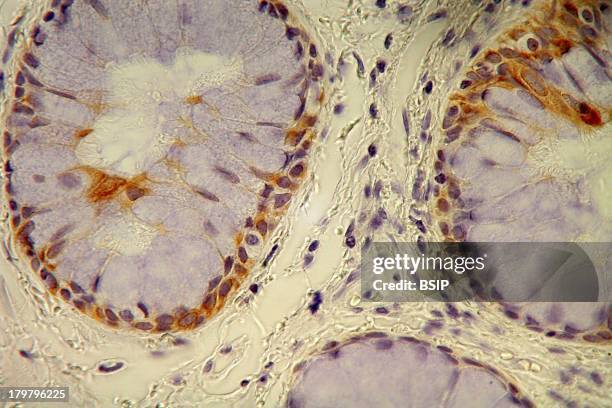 Bronchus, Histology, Histological Section Of A Normal Human Adult Bronchi, Staining With An Anti Cytokeratin 19 Antibody, In Brown, And With...