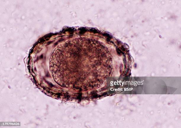 Ascaris Egg, Parasitic Intestinal Nematode, The Larva Causes Human Gastric Anisakidosis Parasitosis And Acute Abdominal Pain Syndrome, Microscope...