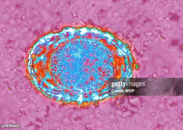 Ascaris Egg, Parasitic Intestinal Nematode, The Larva Causes Human Gastric Anisakidosis Parasitosis And Acute Abdominal Pain Syndrome, Microscope...